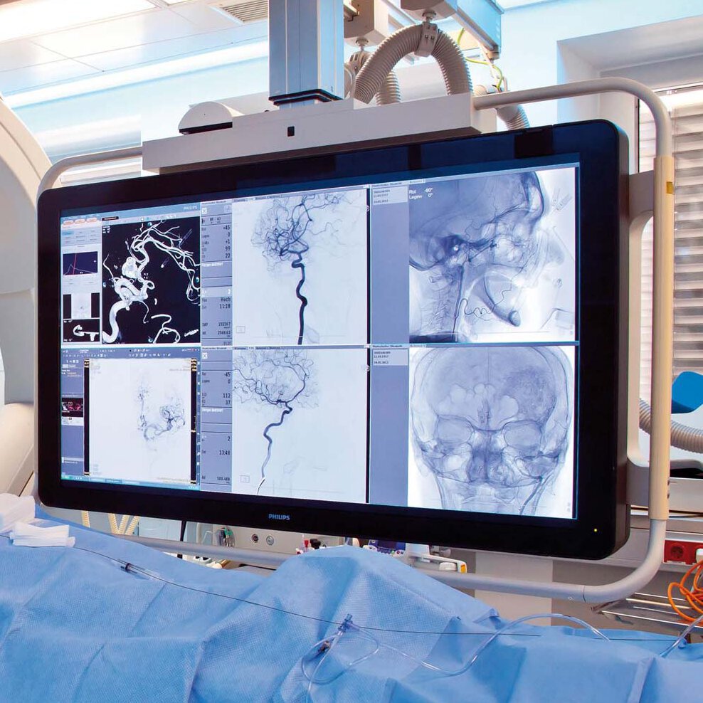 Mergers, acquisitions, M&A, healthcare, life sciences, medical devices, endoscopy, diagnostic imaging, minimally invasive, consulting, advisor
