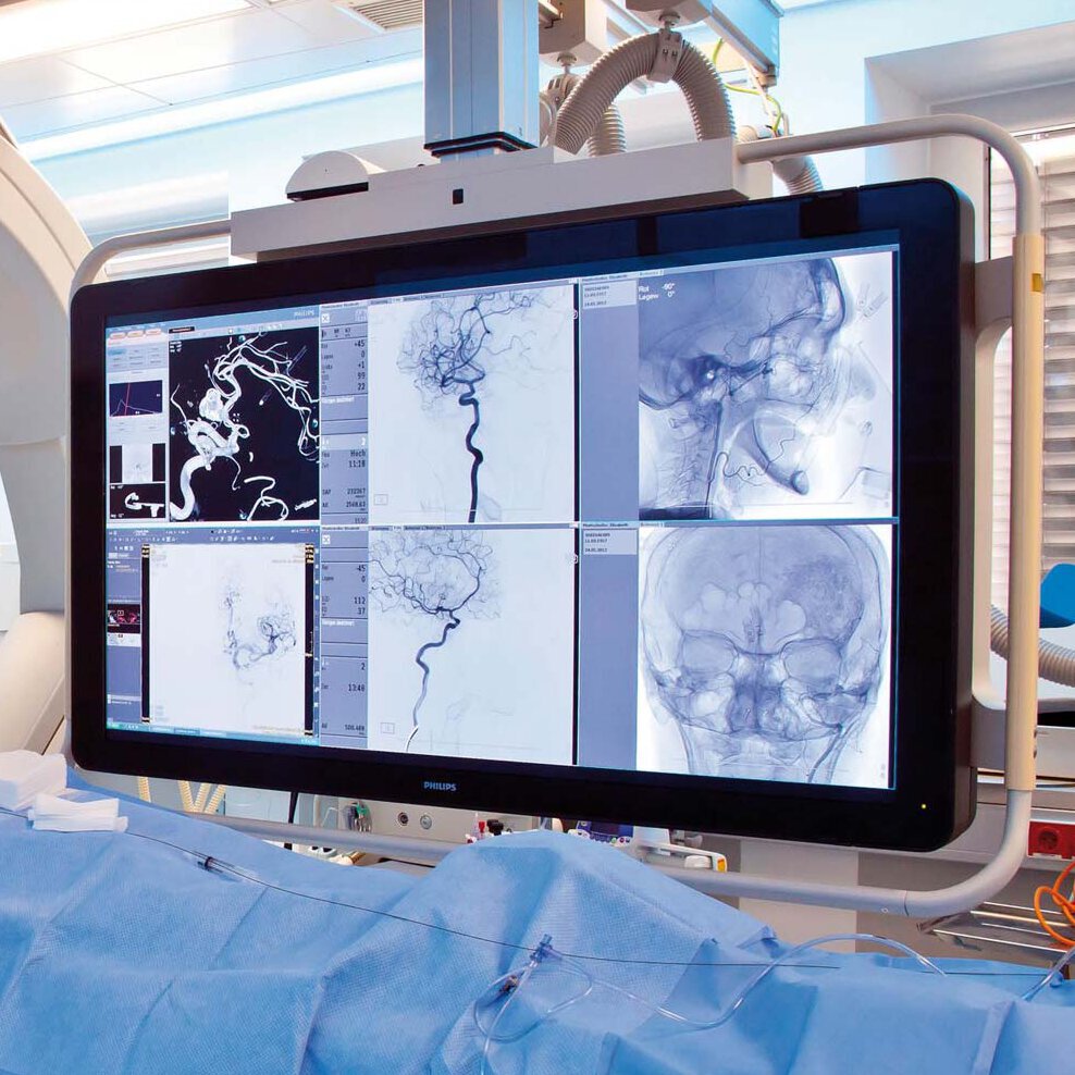 Mergers, Acquisitions, M&A, Health Care, Life Sciences, Medical Devices, Endoscopy, Diagnostic Imaging, Minimal Invasive, Beratung, Berater